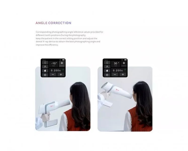 Портативный рентген Woodpecker Ai Ray білий WDP006740 фото